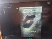 Young Mare with Excellent Pedigree and Foal by Douglas 